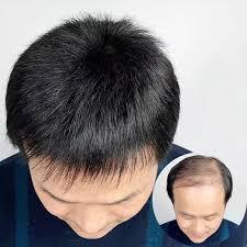 Chinese Hair Patch