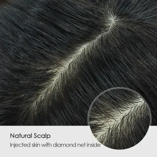 Miraj hair patch Skin Based