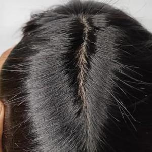 Golden Miraj Hair Patch