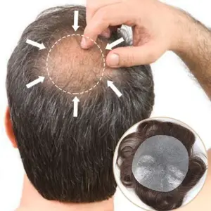 icon Crown hair patch