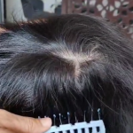 Chinese Hair Patch